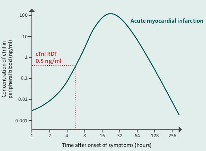 Rapid Detection Of Cardiac Troponin To Help Diagnose Myocardial Infarction HUMAN Diagnostics