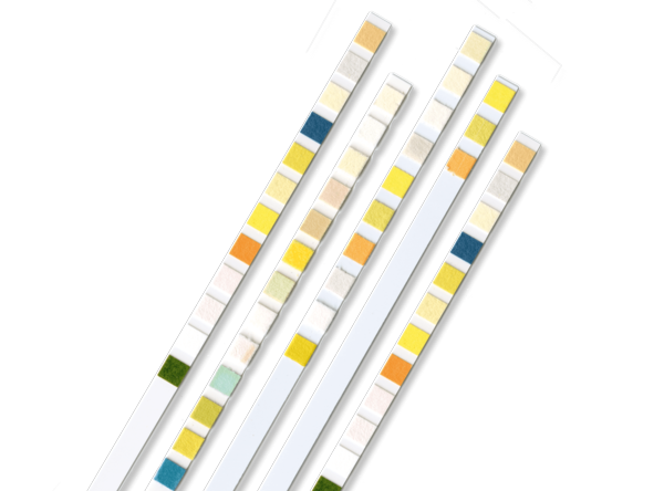 Urinalysis - Human Diagnostics Worldwide